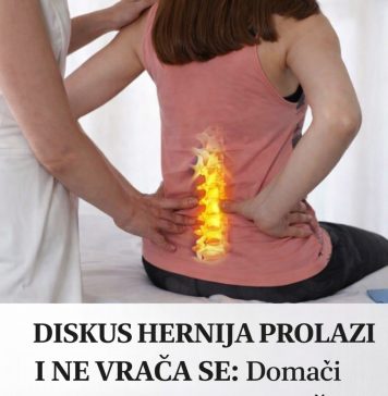 DISKUS HERNIJA PROLAZI I NE VRAĆA SE: Domaći lijek koji OBNAVLJA KIČMU, JAČA JE I LIJEČI DISKUS HERNIJA PROLAZI I NE VRAĆA SE: Domaći lijek koji OBNAVLJA KIČMU, JAČA JE I LIJEČI - featured image