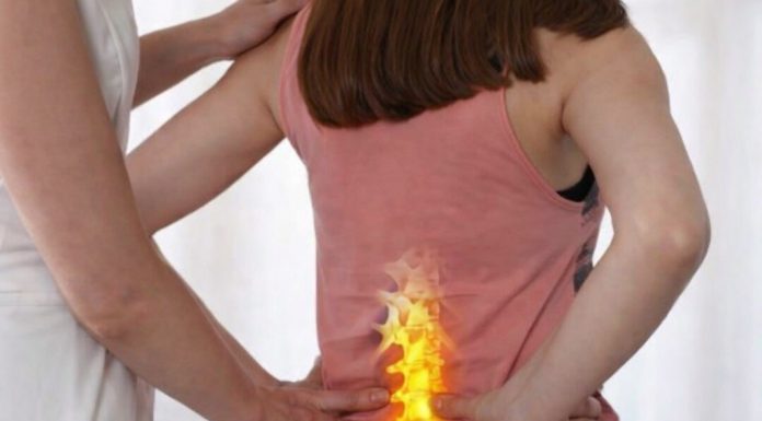 DISKUS HERNIJA PROLAZI I NE VRAĆA SE: Domaći lijek koji OBNAVLJA KIČMU, JAČA JE I LIJEČI DISKUS HERNIJA PROLAZI I NE VRAĆA SE: Domaći lijek koji OBNAVLJA KIČMU, JAČA JE I LIJEČI - featured image