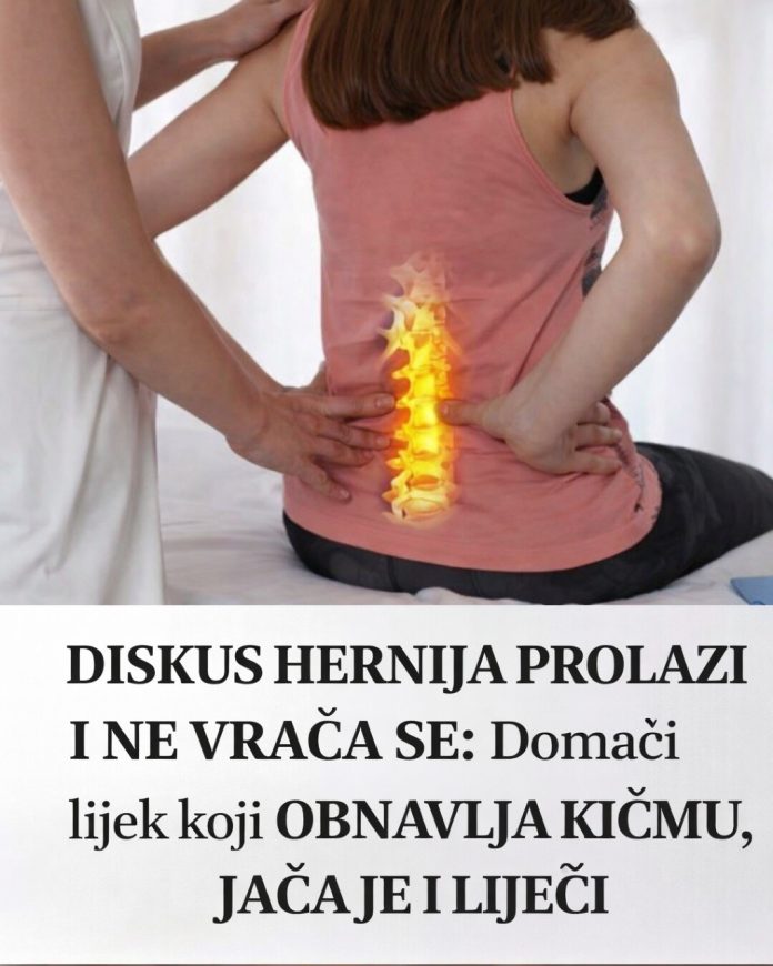 DISKUS HERNIJA PROLAZI I NE VRAĆA SE: Domaći lijek koji OBNAVLJA KIČMU, JAČA JE I LIJEČI - featured image DISKUS HERNIJA PROLAZI I NE VRAĆA SE: Domaći lijek koji OBNAVLJA KIČMU, JAČA JE I LIJEČI - featured image