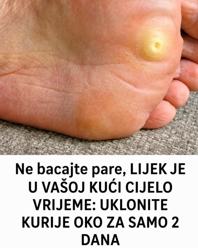 Ne bacajte pare, LIJEK JE U VAŠOJ KUĆI CIJELO VRIJEME: UKLONITE KURIJE OKO ZA SAMO 2 DANA - featured image Ne bacajte pare, LIJEK JE U VAŠOJ KUĆI CIJELO VRIJEME: UKLONITE KURIJE OKO ZA SAMO 2 DANA - featured image
