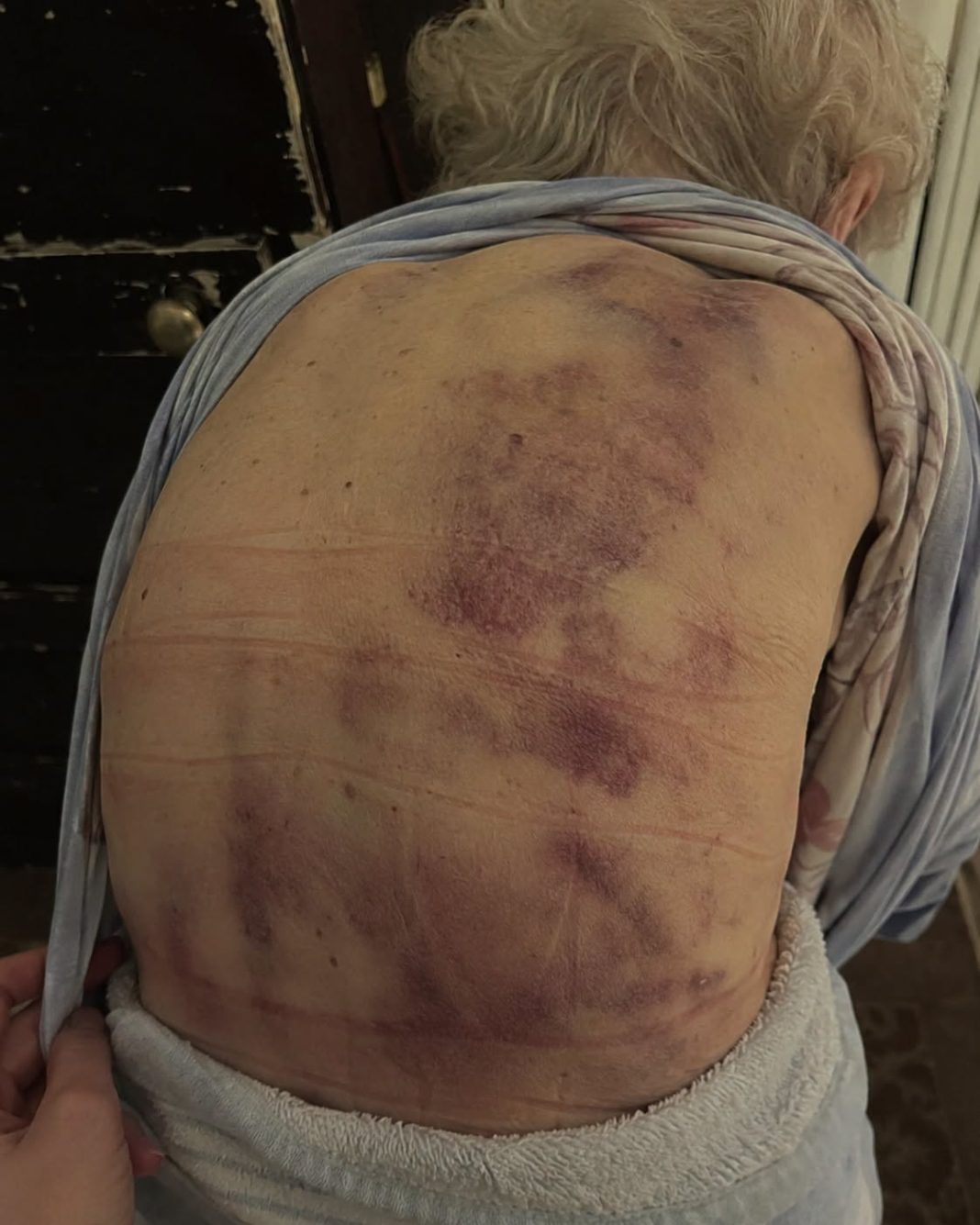 Vratila sam se kući kako bih pomogla svojoj starijoj majci da se okupa. Čim sam krenula prema njoj, trgnula se kao da ću je udariti - featured image Vratila sam se kući kako bih pomogla svojoj starijoj majci da se okupa. Čim sam krenula prema njoj, trgnula se kao da ću je udariti - featured image